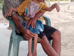 Anak 11 Tahun Penderita Kejang di Tubaba Terabaikan, Kinerja Dinas Sosial dan Pemda Dipertanyakan.