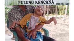‎BPJS Nonaktif, Bocah Penderita Epilepsi di Tubaba Terancam Putus Pengobatan: Dinas Sosial Dinilai Abai.