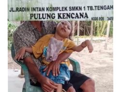 ‎BPJS Nonaktif, Bocah Penderita Epilepsi di Tubaba Terancam Putus Pengobatan: Dinas Sosial Dinilai Abai.