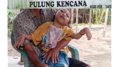 ‎BPJS Nonaktif, Bocah Penderita Epilepsi di Tubaba Terancam Putus Pengobatan: Dinas Sosial Dinilai Abai.